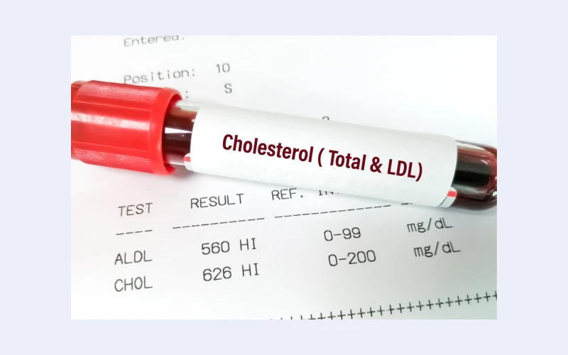 Private Cholesterol Test in London – Fast, Accurate & Confidential Results